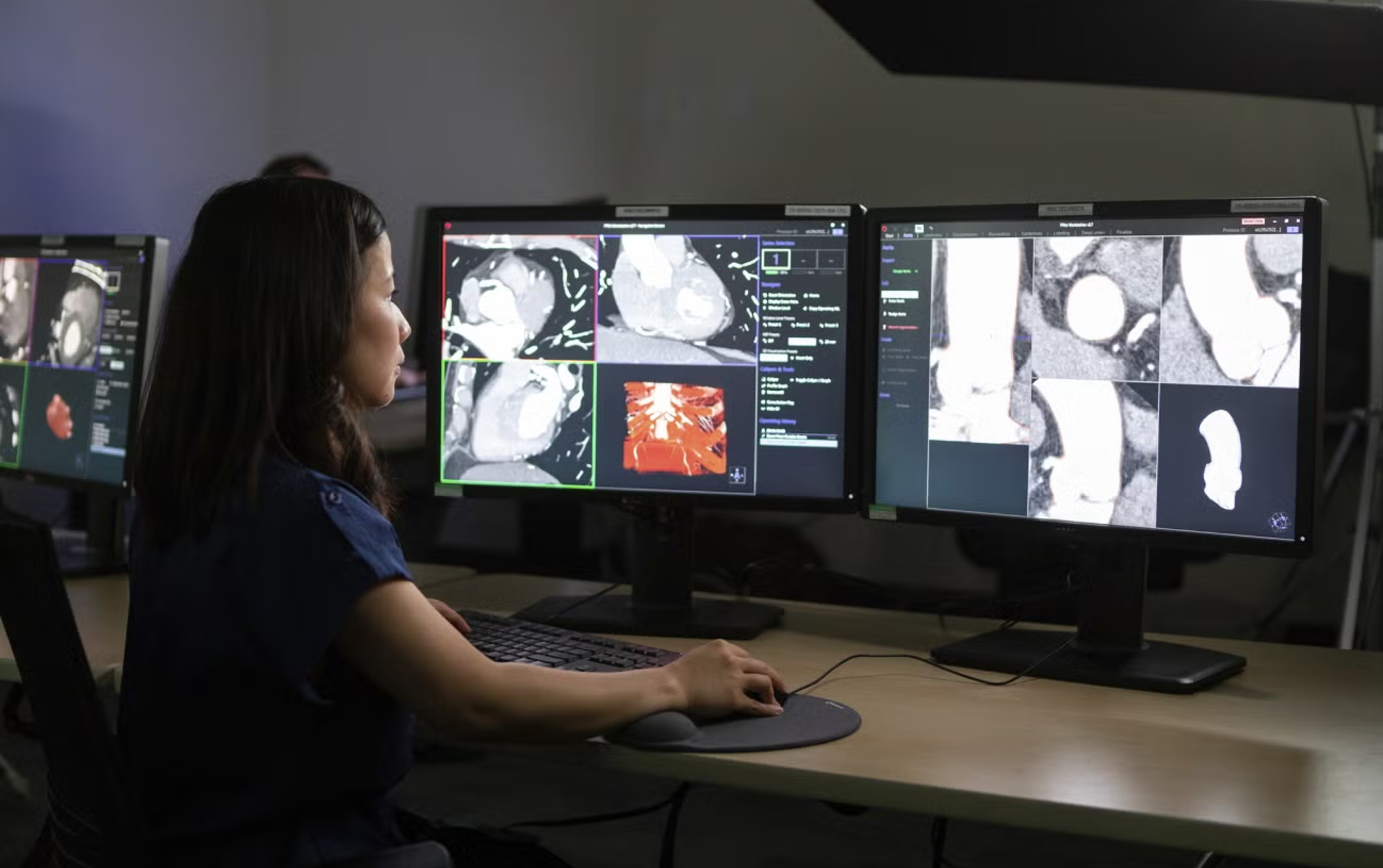 A person examining CT heart scans and creating a 3D model from them